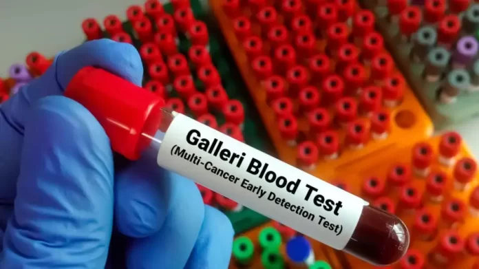 Galleri blood test for early detection of cancer